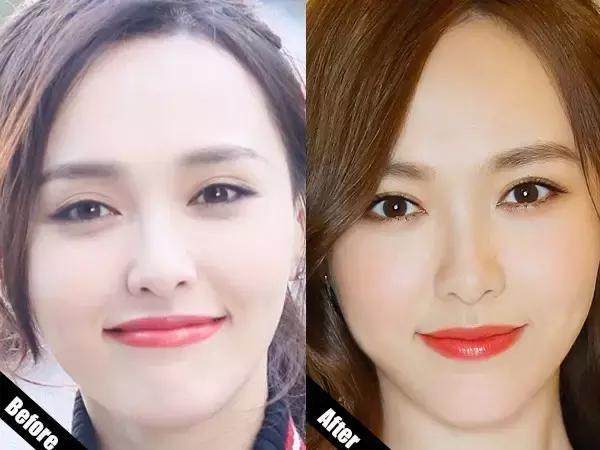 赵丽颖杨幂唐嫣双眼皮都是这样"整"的