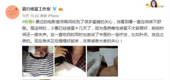 杨幂被疑脖子上惊险吻痕,真相其实是