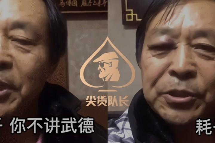 " "他突然袭击左刺拳,打我脸,我大意了啊,没有闪.